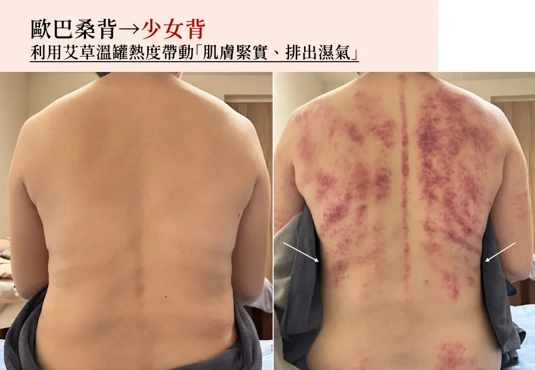 艾草溫罐調理